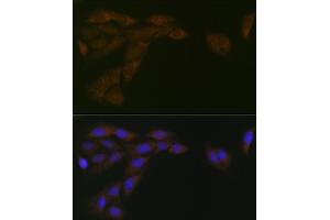 Immunofluorescence analysis of U-2 OS cells using CYPOR Rabbit mAb (ABIN7269151) at dilution of 1:100 (40x lens). (POR 抗体)