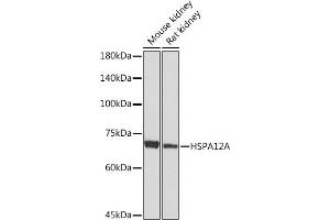 Western blot analysis of extracts of various cell lines, using HSPA Rabbit mAb (ABIN7267576) at 1:1000 dilution. (HSPA12A 抗体)