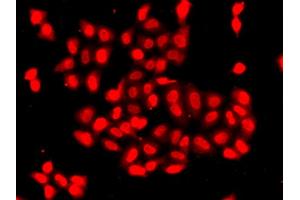 Immunofluorescence analysis of A549 cells using CAMK1D antibody (ABIN5975586). (CAMK1D 抗体)
