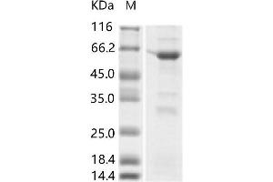 Western Blotting (WB) image for Zika Virus Envelope (ZIKV E) protein (His tag,MBP tag) (ABIN7198748) (ZIKV E Protein (His tag,MBP tag))