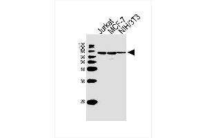 Lane 1: Jurkat Cell lysates, Lane 2: MCF-7 Cell lysates, Lane 3: NIH/3T3 Cell lysates, probed with RPS6KB2 (164CT21. (RPS6KB2 抗体)