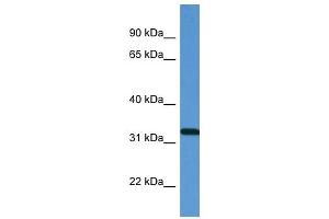 Western Blot showing ZAP70 antibody used at a concentration of 1 ug/ml against Fetal Lung Lysate (ZAP70 抗体  (N-Term))