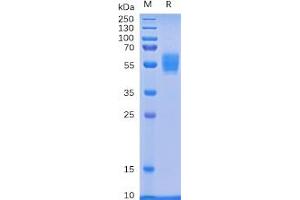 Human NKG2D Protein, mFc Tag on SDS-PAGE under reducing condition.