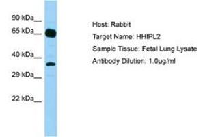Image no. 1 for anti-HHIP-Like 2 (HHIPL2) (AA 606-655) antibody (ABIN6750191) (HHIPL2 抗体  (AA 606-655))