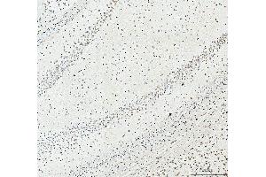 IHC analysis of SFPQ using anti-SFPQ antibody (ABIN7603089). (SFPQ 抗体  (Middle Region))