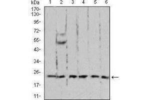Western blot analysis using RAN mouse mAb against A431 (1), C6 (2), Jurkat (3), Hela (4), COS7 (5), and Jurkat (6) cell lysate. (RAN 抗体  (AA 1-216))