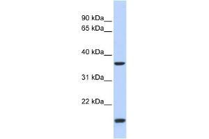 WB Suggested Anti-ZIC4 Antibody Titration:  0. (ZIC4 抗体  (N-Term))