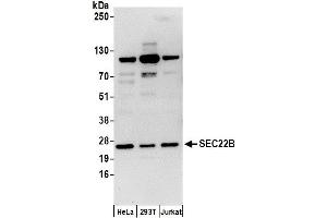 anti-SEC22b Vesicle Trafficking Protein (SEC22B) (AA 100-150) antibody