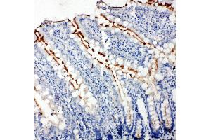 Anti-Zonula occludens protein 3 antibody, IHC(P) IHC(P): Rat Intestine Tissue