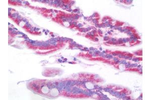 Anti-SCNN1B / ENaC Beta antibody IHC staining of human intestine. (SCNN1B 抗体  (AA 306-332))