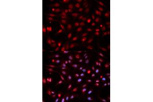 Immunofluorescence analysis of HeLa cells using APEX1 antibody. (APEX1 抗体)