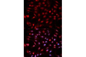 Immunofluorescence analysis of HeLa cells using APEX1 antibody. (APEX1 抗体)