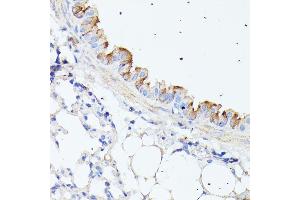 Immunohistochemistry (IHC) image for anti-Heat Shock Protein Family B (Small), Member 11 (HSPB11) antibody (ABIN7267591)