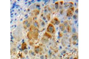 Used in DAB staining on fromalin fixed paraffin- embedded liver tissue (IL-11 抗体  (AA 22-199))