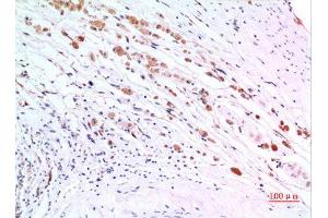 Immunohistochemistry (IHC) analysis of paraffin-embedded Human Brain, antibody was diluted at 1:100. (ZKSCAN4 抗体  (Internal Region))