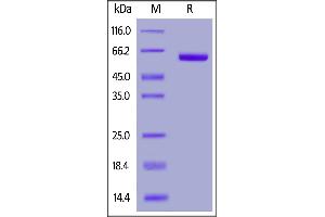 SDS-PAGE (SDS) image for SARS-CoV-2 Spike S1 (RBD) protein (Fc Tag) (ABIN6952462)