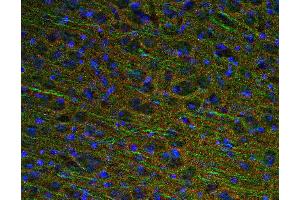 Indirect immunostaining of PFA fixed mouse brain section with anti-GAP 43 (dilution 1 : 500; red) and rabbit anti-MAP 2 (cat. (GAP43 抗体)