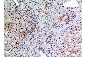 Immunohistochemistry (IHC) image for anti-B-Cell CLL/lymphoma 6 (BCL6) (Internal Region) antibody (ABIN3187827)
