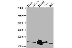 Western Blot Positive WB detected in: Mouse Liver tissue, Mouse Spleen tissue, Mouse kidney tissue, Mouse Brain tissue, Hela whole cell lysate All lanes: Mif antibody at 1:2000 Secondary Goat polyclonal to rabbit IgG at 1/50000 dilution Predicted band size: 13 kDa Observed band size: 13 kDa (MIF 抗体  (AA 2-115))