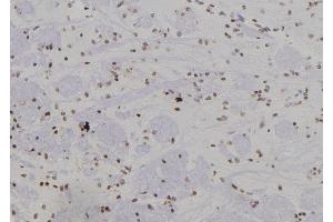 ABIN6277441 at 1/100 staining Rat brain tissue by IHC-P. (SUMO4 抗体)
