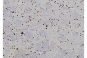 ABIN6277441 at 1/100 staining Rat brain tissue by IHC-P.