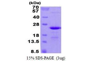 Image no. 1 for Chromosome 17 Open Reading Frame 49 (C17orf49) protein (His tag) (ABIN1098372) (C17orf49 Protein (His tag))