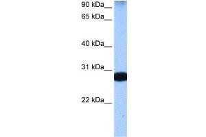 WB Suggested Anti-STAU1  Antibody Titration: 0. (STAU1/Staufen 抗体  (N-Term))
