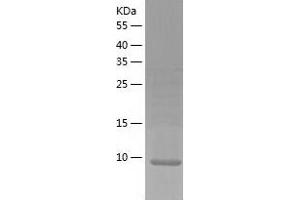 SBEM Protein (AA 21-90) (His tag)