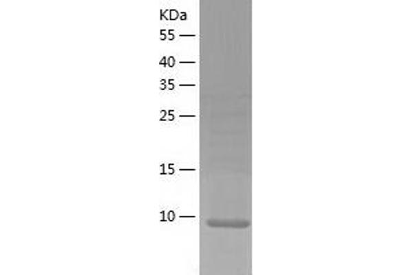 SBEM Protein (AA 21-90) (His tag)