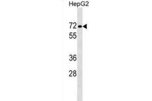 Western Blotting (WB) image for anti-Protein Phosphatase 1, Regulatory Subunit 16B (PPP1R16B) antibody (ABIN2999569) (PPP1R16B 抗体)