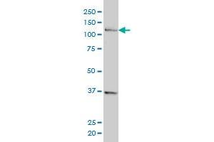 Western Blotting (WB) image for anti-CTF18, Chromosome Transmission Fidelity Factor 18 Homolog (CHTF18) (AA 886-975) antibody (ABIN566224)