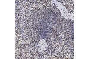 IHC analysis of U1A/SNRPA using anti-U1A/SNRPA antibody (ABIN7600891). (SNRPA1 抗体  (AA 25-218))