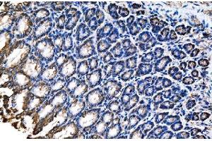 IHC analysis of Claudin18/CLDN18 using anti-Claudin18/CLDN18 antibody (ABIN7601257). (Claudin 18 抗体  (AA 31-261))