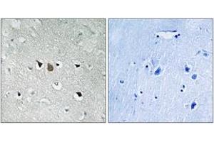 Immunohistochemistry analysis of paraffin-embedded human brain tissue, using C-RAF (Ab-269) Antibody. (RAF1 抗体  (AA 231-280))