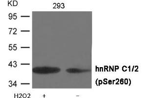 Western blot analysis of extracts from 293 cells untreated or treated with H2O2 using hnRNP C1/2 (Phospho-Ser260) Antibody . (HNRNPC 抗体  (pSer260))