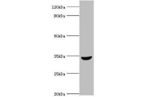 Western blot All lanes: MSI2 antibody at 10 μg/mL + HepG2 whole cell lysate Secondary Goat polyclonal to rabbit IgG at 1/10000 dilution Predicted band size: 36, 29, 18 kDa Observed band size: 36 kDa