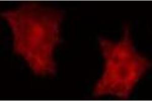 Immunofluorescence (fixed cells) (IF/ICC) image for anti-ATPase, H+ Transporting, Lysosomal 42kDa, V1 Subunit C2 (ATP6V1C2) (Internal Region) antibody (ABIN6256921)