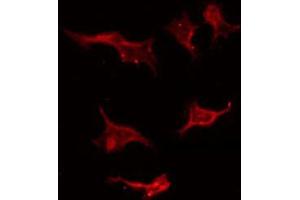 ABIN6267405 staining Hela by IF/ICC. (Stathmin 1 抗体  (pSer25))