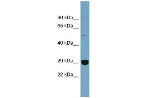 WB Suggested Anti-HMGB2 Antibody Titration: 0. (HMGB2 抗体  (Middle Region))