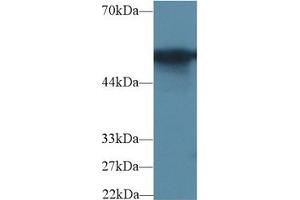 Western blot analysis of Rat Colon lysate, using Rat G6PD Antibody (2 µg/ml) and HRP-conjugated Goat Anti-Rabbit antibody ( (Glucose-6-Phosphate Dehydrogenase 抗体  (AA 1-515))