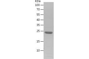 Western Blotting (WB) image for Jun Proto-Oncogene (JUN) (AA 75-274) protein (His tag) (ABIN7123652) (C-JUN Protein (AA 75-274) (His tag))