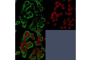 Confocal immunofluorescence analysis of MCF-7 cells using EpCAM Mouse Recombinant Monoclonal Antibody (rMOC-31) labeled in Green. (Recombinant EpCAM 抗体)