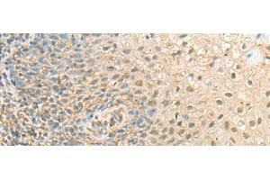 Immunohistochemistry of paraffin-embedded Human tonsil tissue using PPCDC Polyclonal Antibody at dilution of 1:55(x200) (PPCDC 抗体)