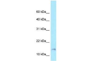 WB Suggested Anti-BAD Antibody Titration: 1. (BAD 抗体  (Middle Region))