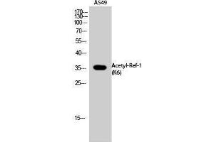Western Blotting (WB) image for anti-Apurinic/Apyrimidinic Endonuclease 1 (APEX1) (acLys6) antibody (ABIN3181880) (APEX1 抗体  (acLys6))