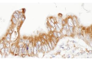 Immunohistochemistry (IHC) image for anti-Protein Disulfide Isomerase Family A, Member 6 (PDIA6) (AA 390-440) antibody (ABIN7453917)