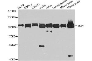 Western blot analysis of extracts of various cell lines, using TOP1 antibody. (Topoisomerase I 抗体)