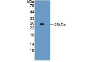 Detection of Recombinant CDCP1, Human using Polyclonal Antibody to CUB Domain Containing Protein 1 (CDCP1) (CDCP1 抗体  (AA 689-836))