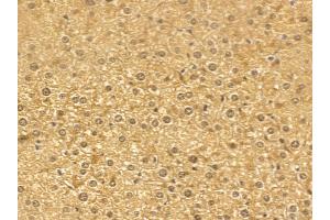 TBC1D21 Mouse Monoclonal Antibody at 1/100 staining mouse liver tissue by IHC-P. (TBC1D21 抗体)