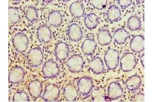 Immunohistochemistry of paraffin-embedded human colon tissue using ABIN7168119 at dilution of 1:100 (POP7 抗体  (AA 1-140))